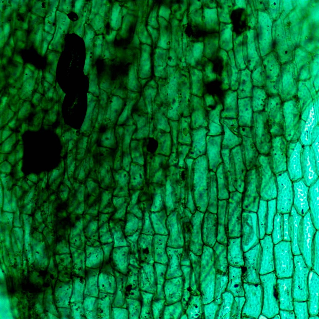 Preparación microscópica de tallo de musgo con hojas