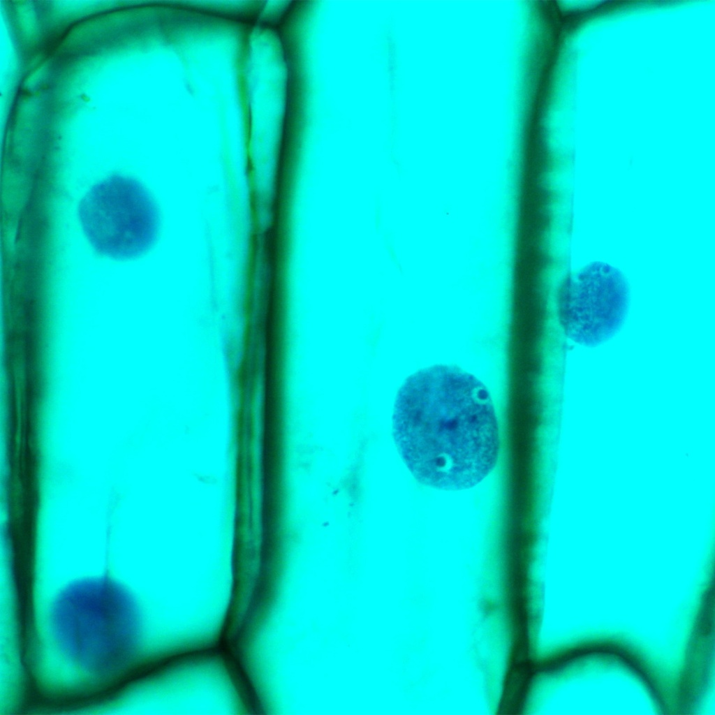 Preparación microscópica de piel de cebolla