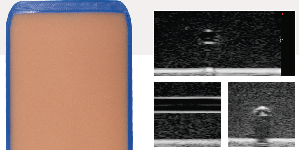 Simulador de ultrasonido para acceso venoso guiado