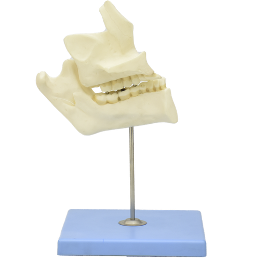 [DENT-JAW] Patologías de dientes con mandíbula