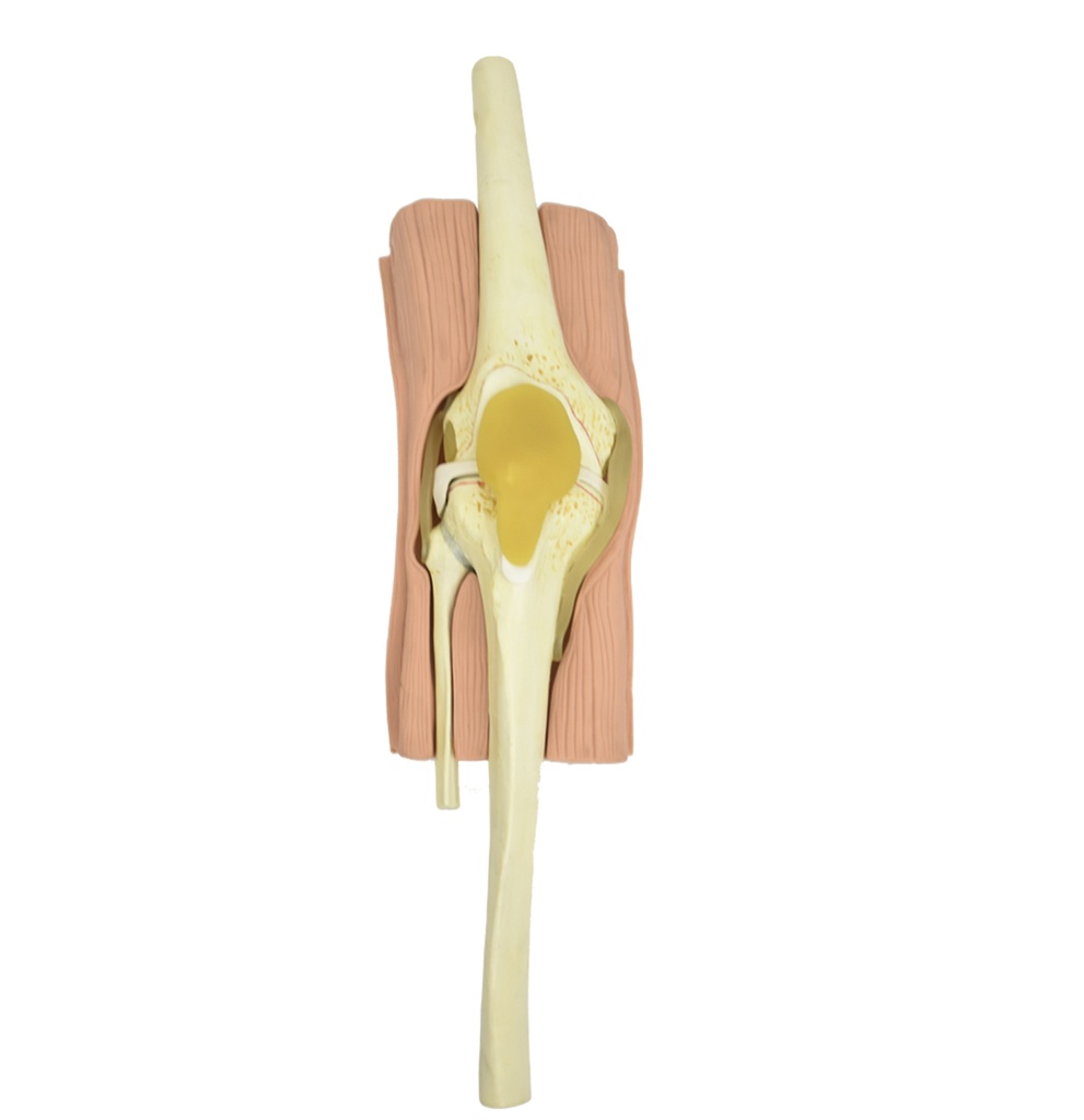 ARTOROSCOPIA DE RODILLA