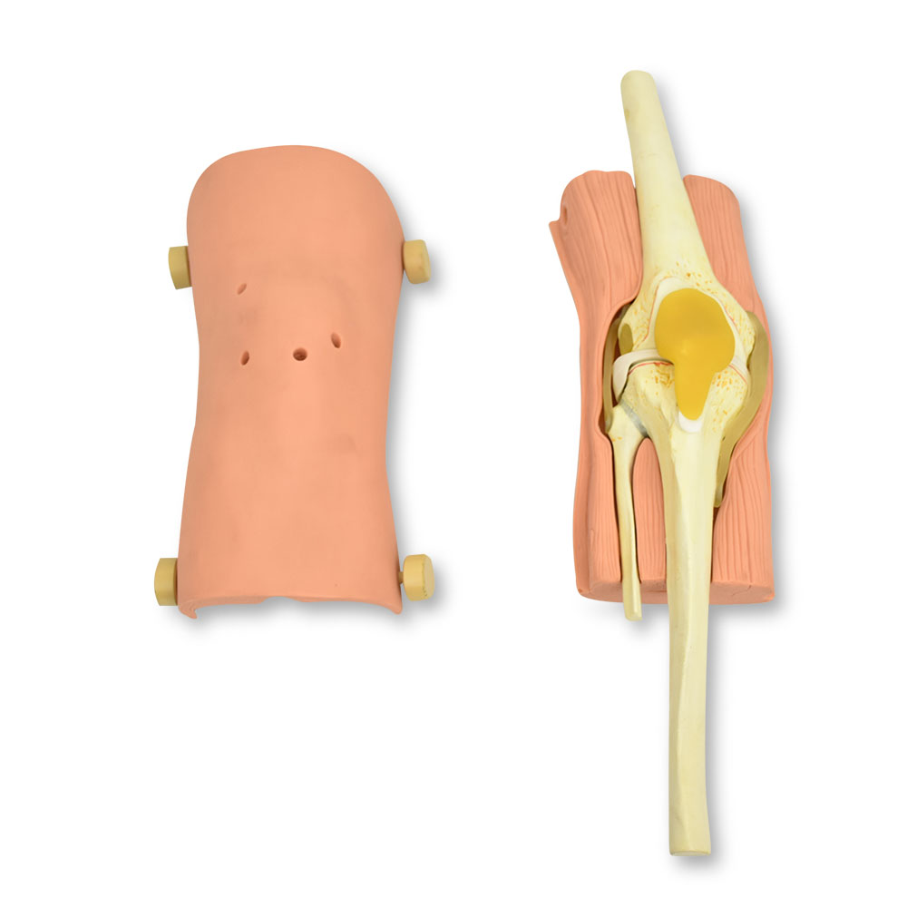 ARTOROSCOPIA DE RODILLA