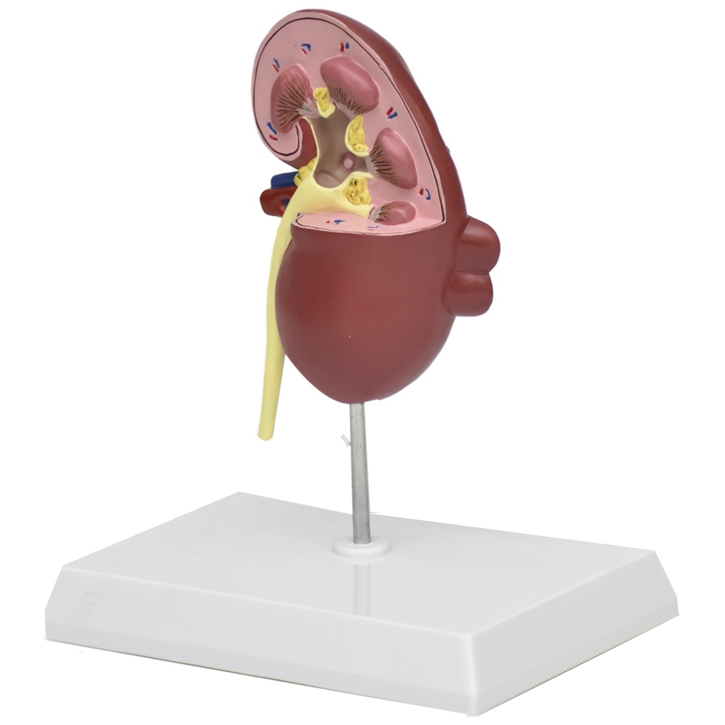 KIDNEY-ENF_4.jpg