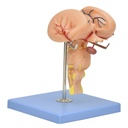 TRONCO-CEREBRAL_2.jpg