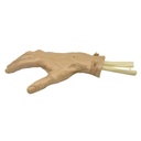 ARTROSCOPIA DE MANO