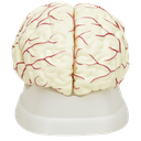 Cerebro blanco con arterias