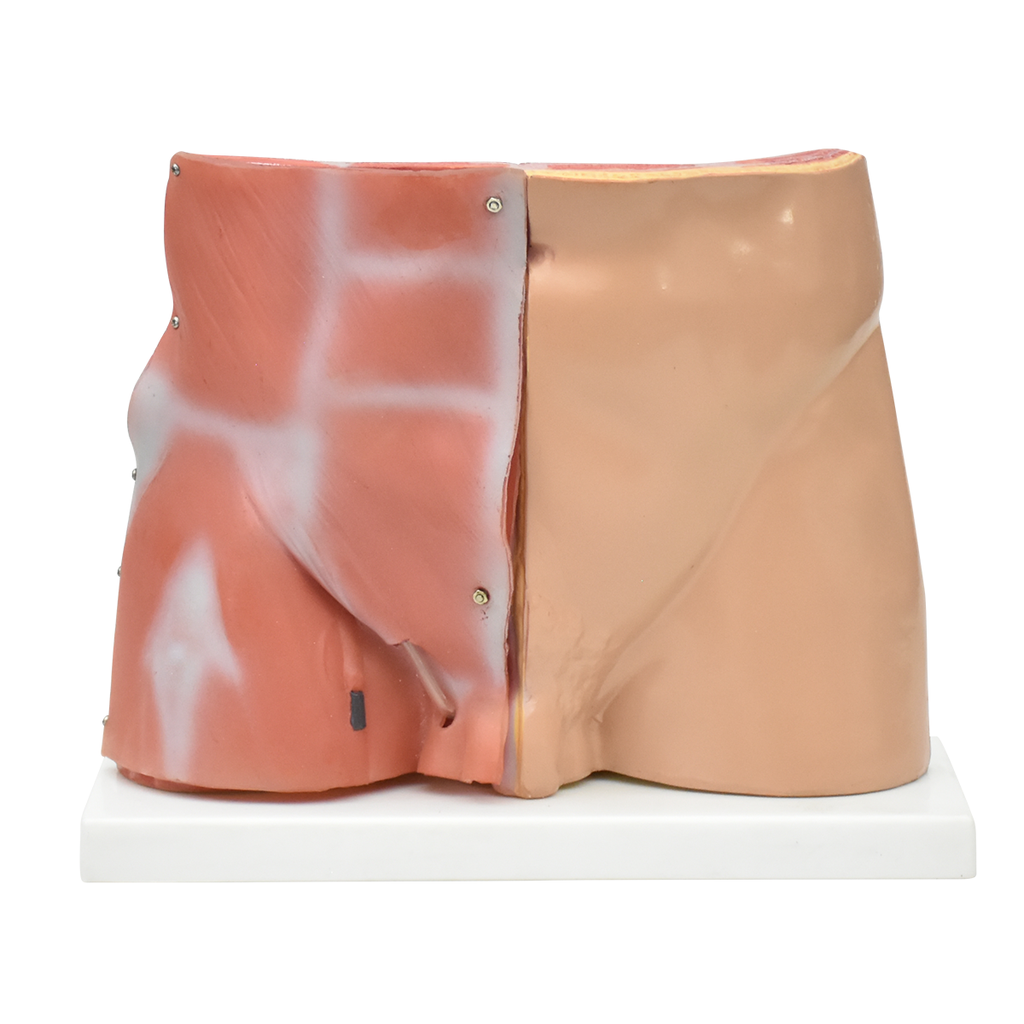 Pelvis masculina inguinal