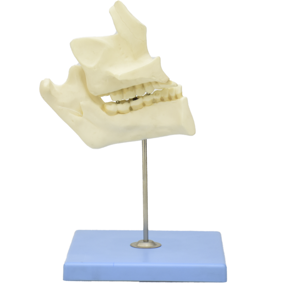Patologías de dientes con mandíbula