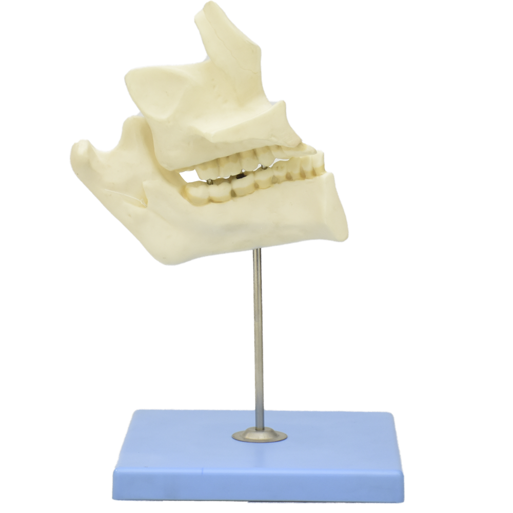 Patologias de dientes con mandibula
