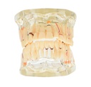 Modelo de dientes
