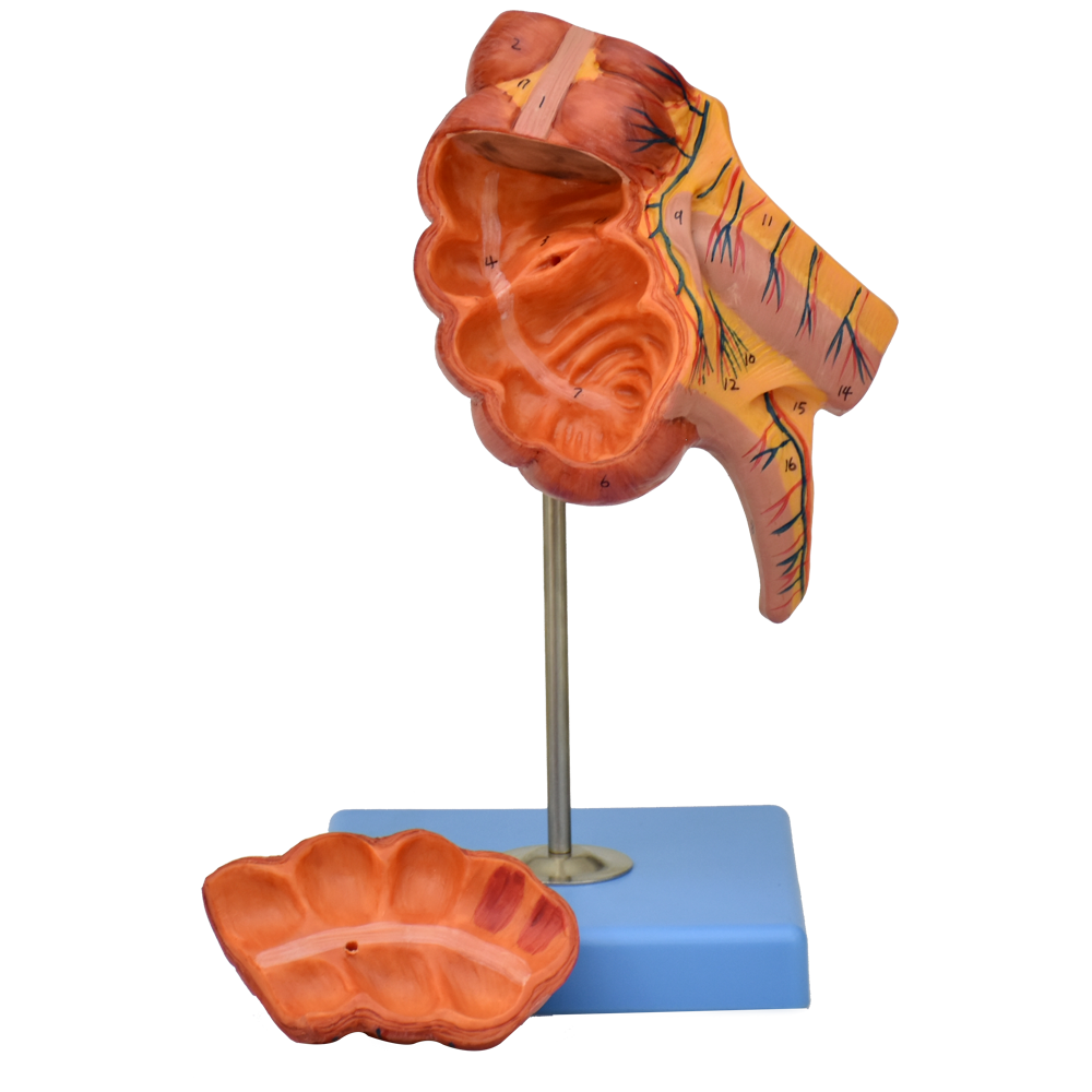 Apéndice e intestino ciego
