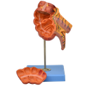 Apéndice e intestino ciego