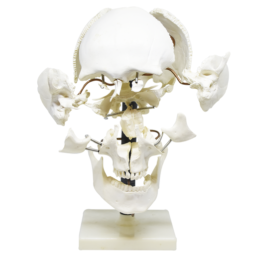 Cráneo disectado