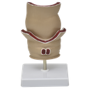 Modelo de recto con patologías