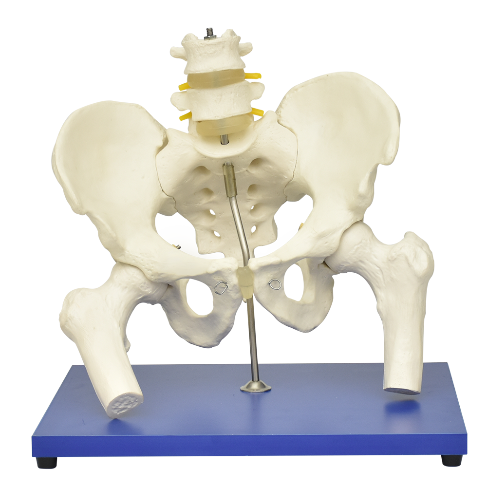 Pelvis con columna lumbar y cabeza femoral