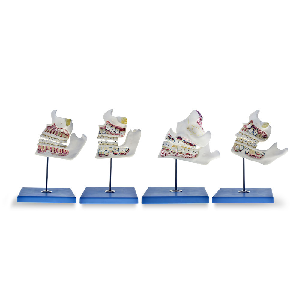 Desarrollo de la dentadura