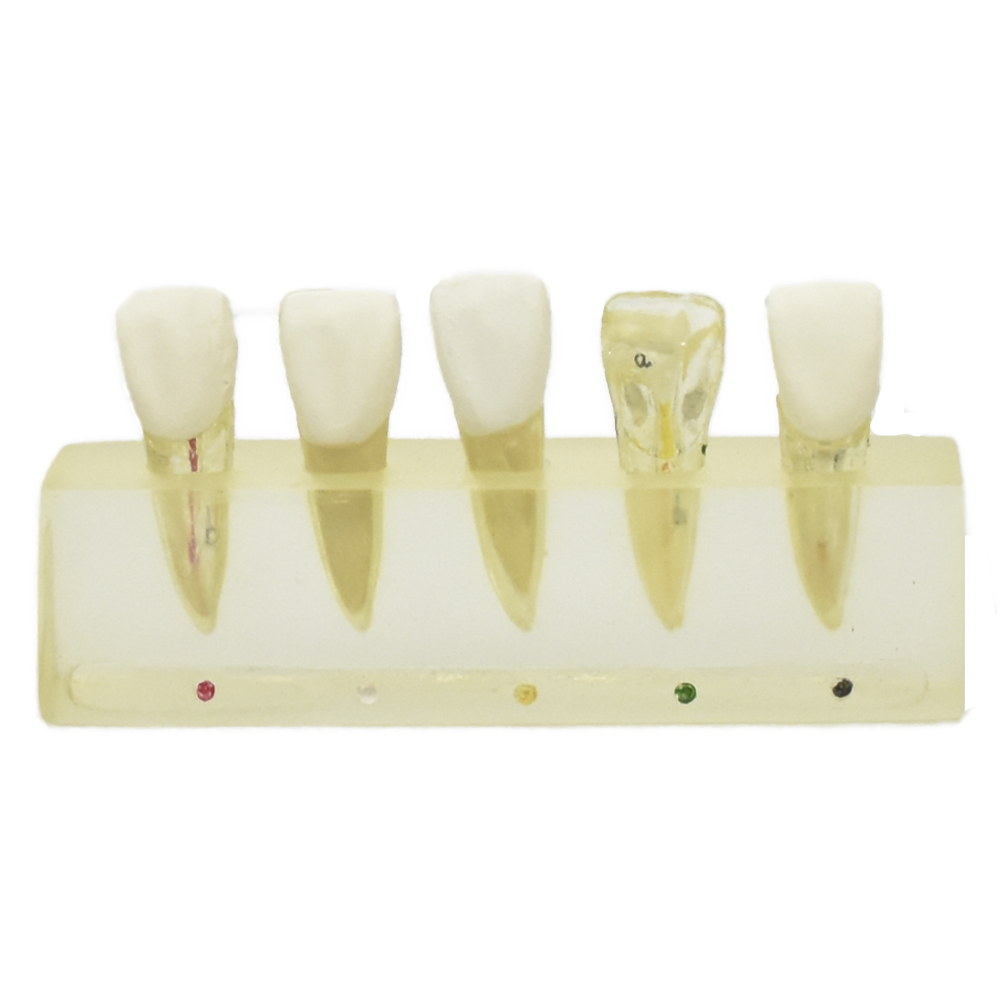 Modelo clinico de endodoncia