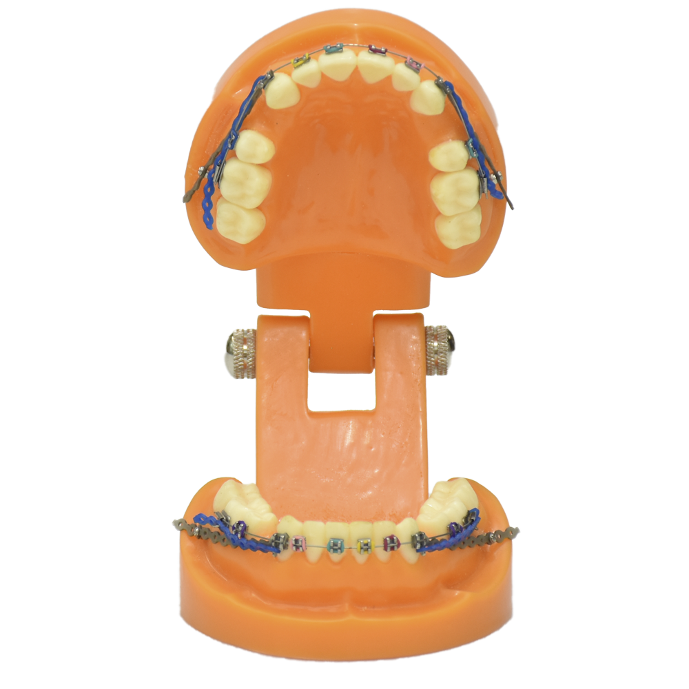 Dentadura para ortodoncia