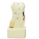 Modelo de molar con padecimientos
