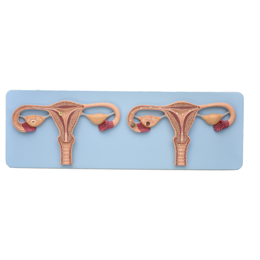 Modelo de fertilización