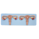Modelo de fertilización