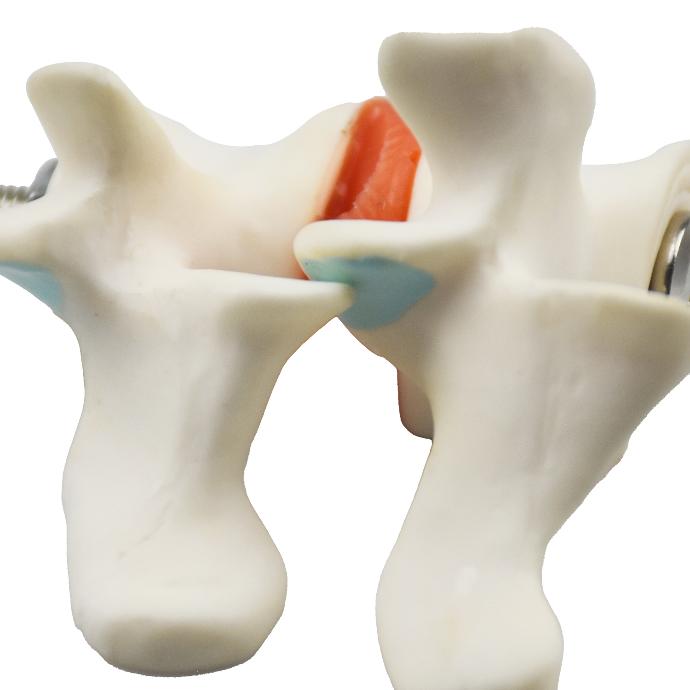 Modelo de osteoporosis sin base