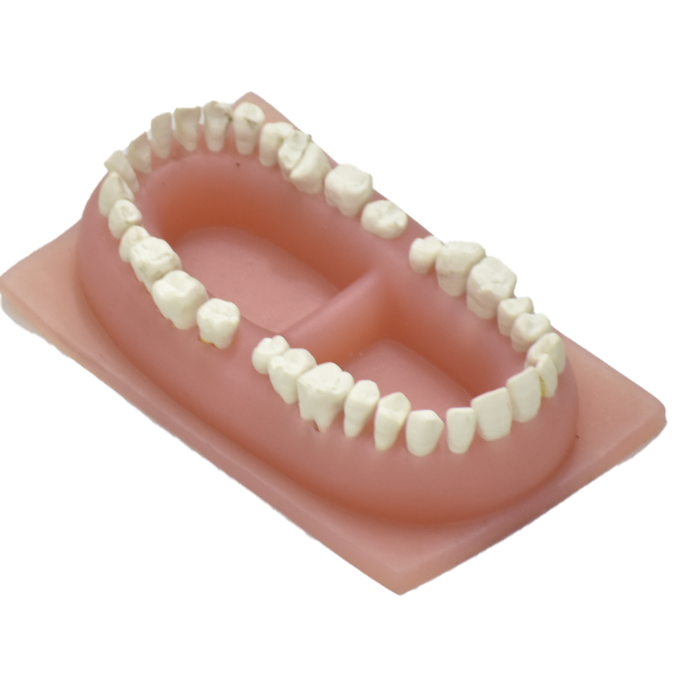 Dentadura de lujo