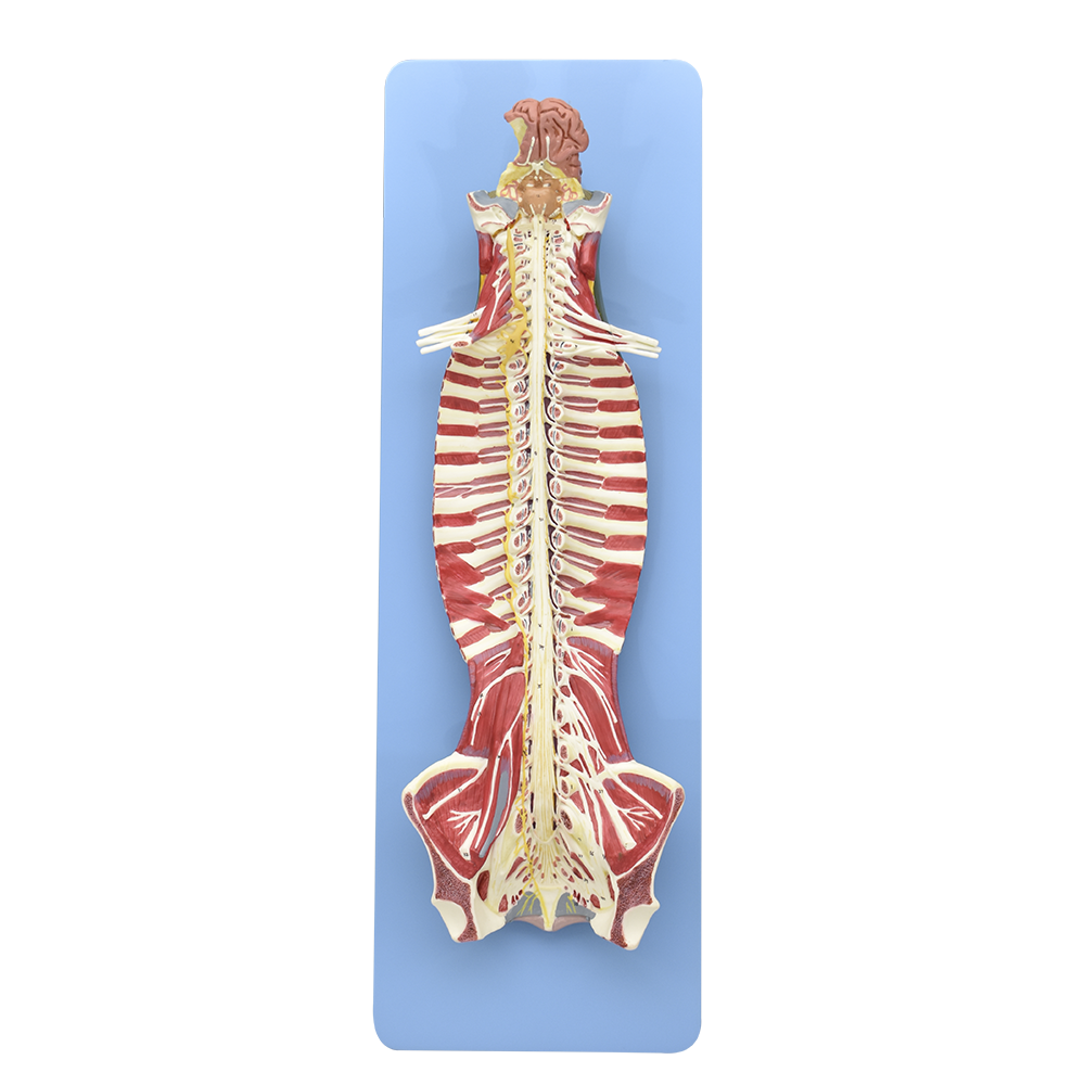 Médula y canal espinal