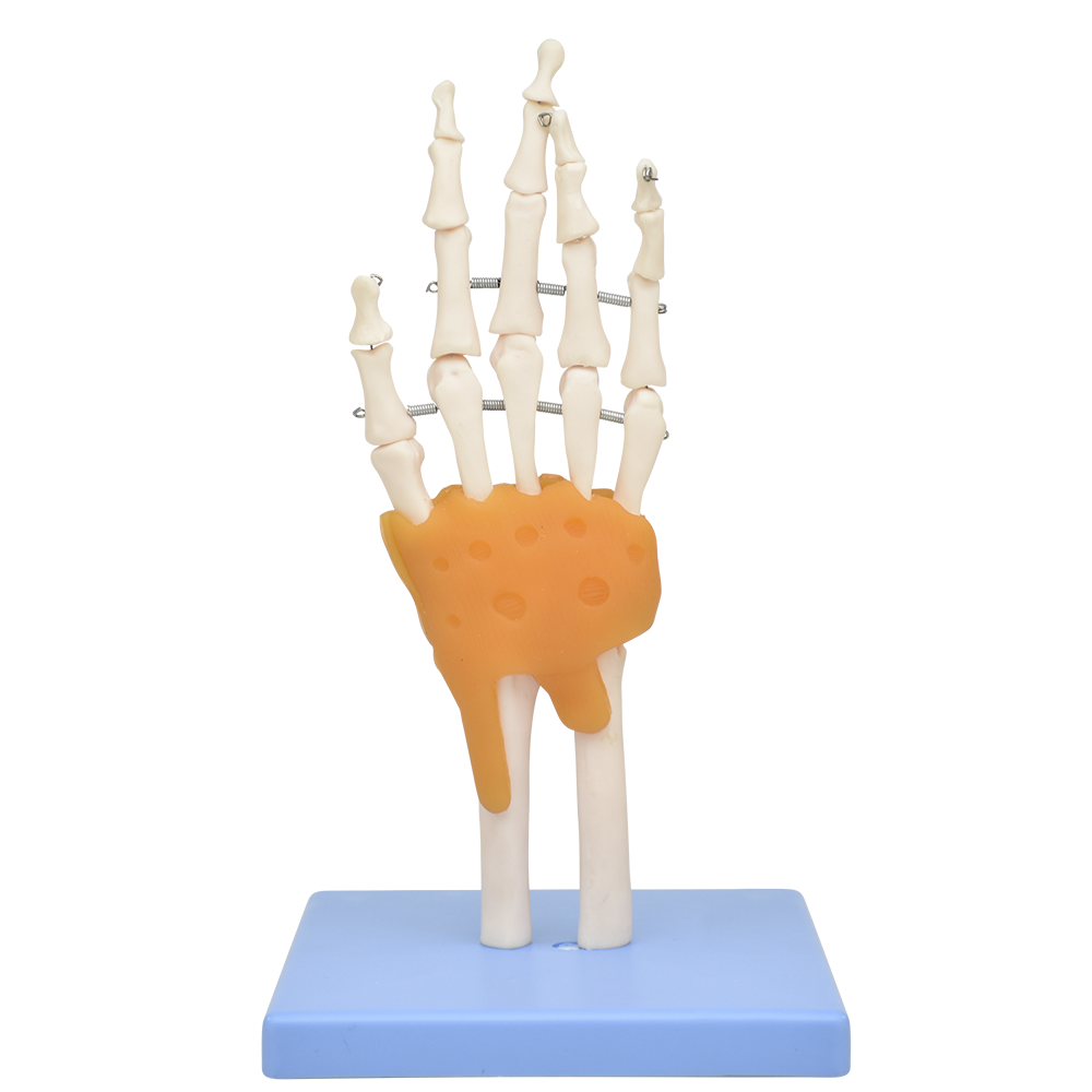 Mano con ligamentos