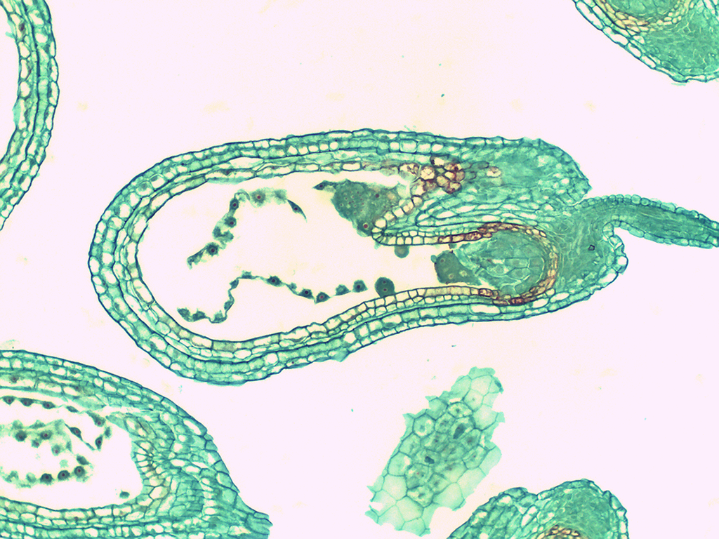 Preparación microscópica de embrión jovén