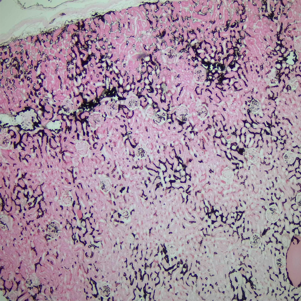 Preparación microscópica de seccion de riñón de conejo