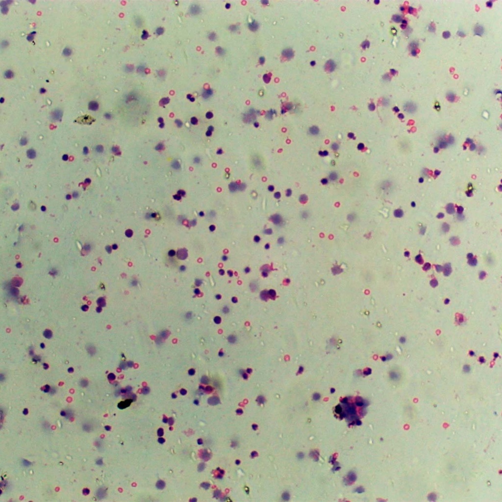 Preparación microscópica de medula ósea de mamífero