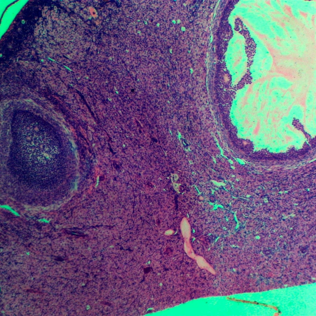 Preparación microscópica de sección de útero de mamífero