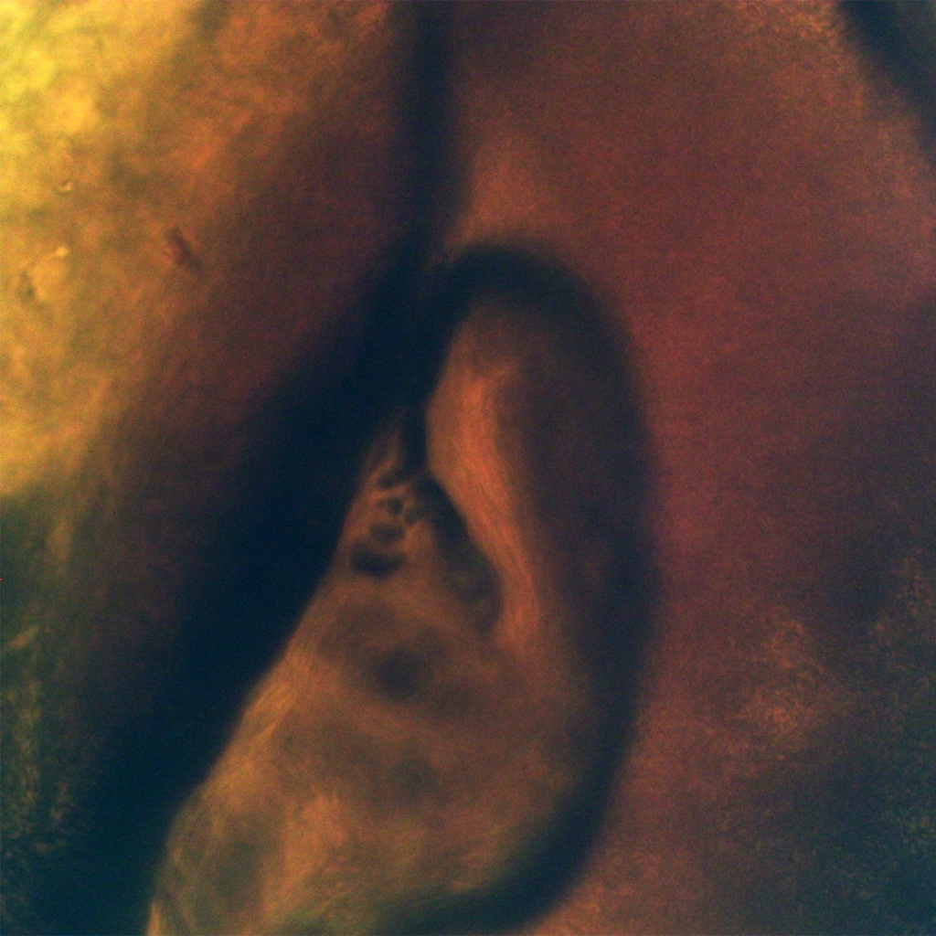 Preparación microscópica de huevos de camarón