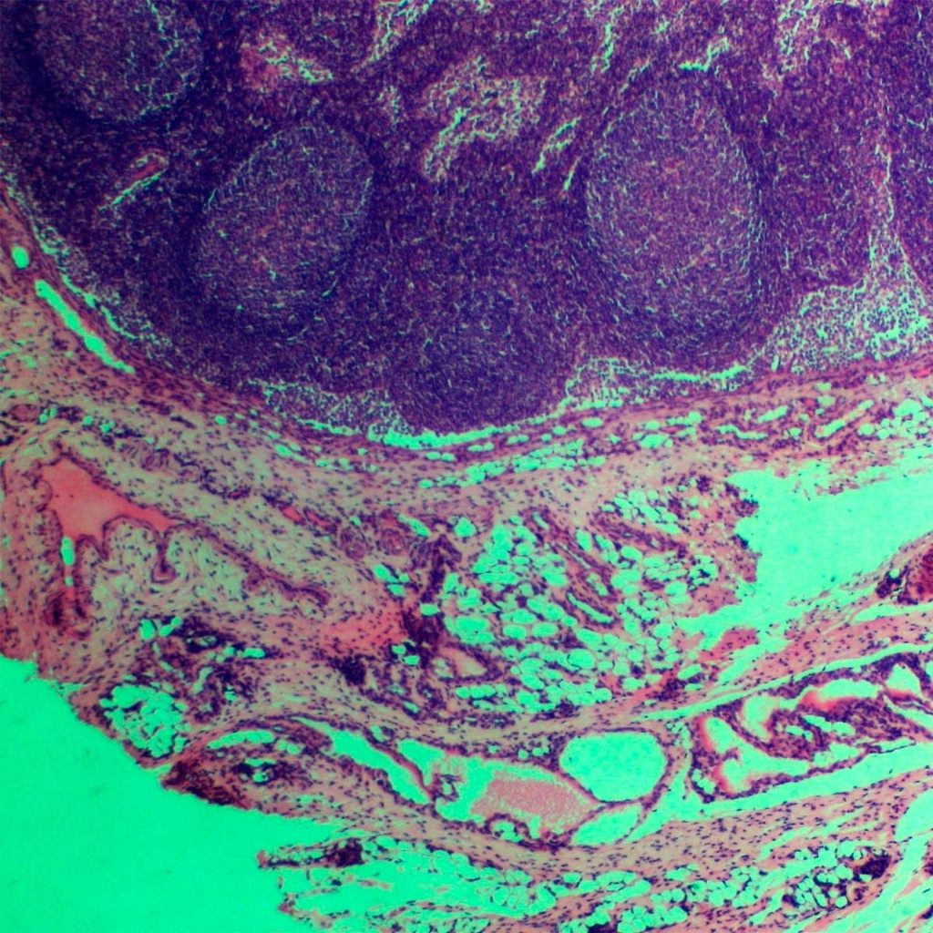 Preparación microscópica de nodo de ganglio linfático de conejo