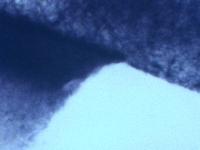 Actinobacteria bacterias gram positivas