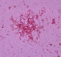 Bacteria de queso