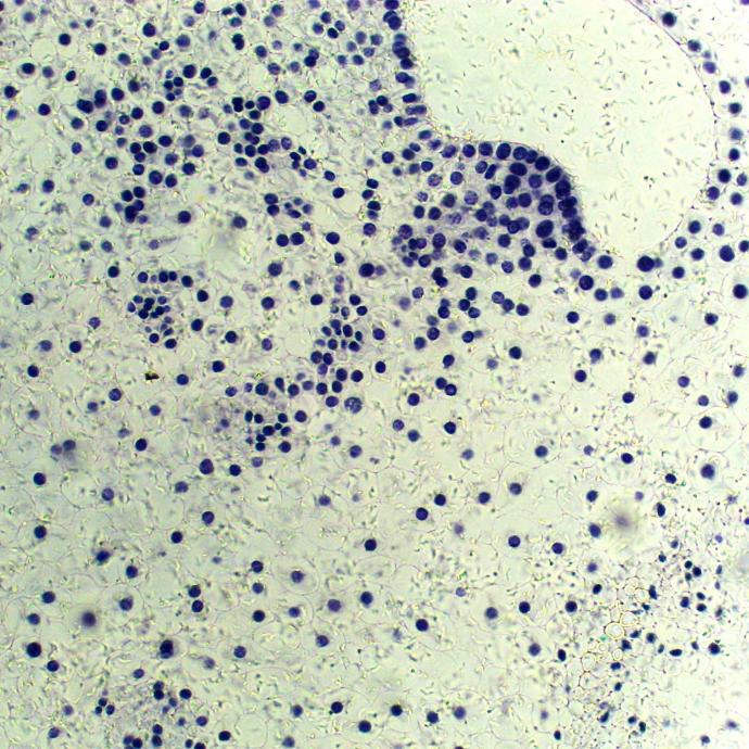 Preparación microscópica de duela hepática china (clonorchis sinesis)