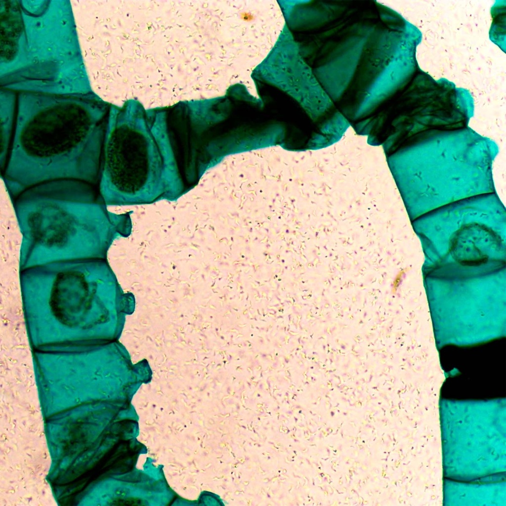 Preparación microscópica de schistosoma tipo de gusano plano parásito en cópula