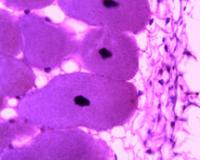 Preparación microscópica de bacteria de raíz