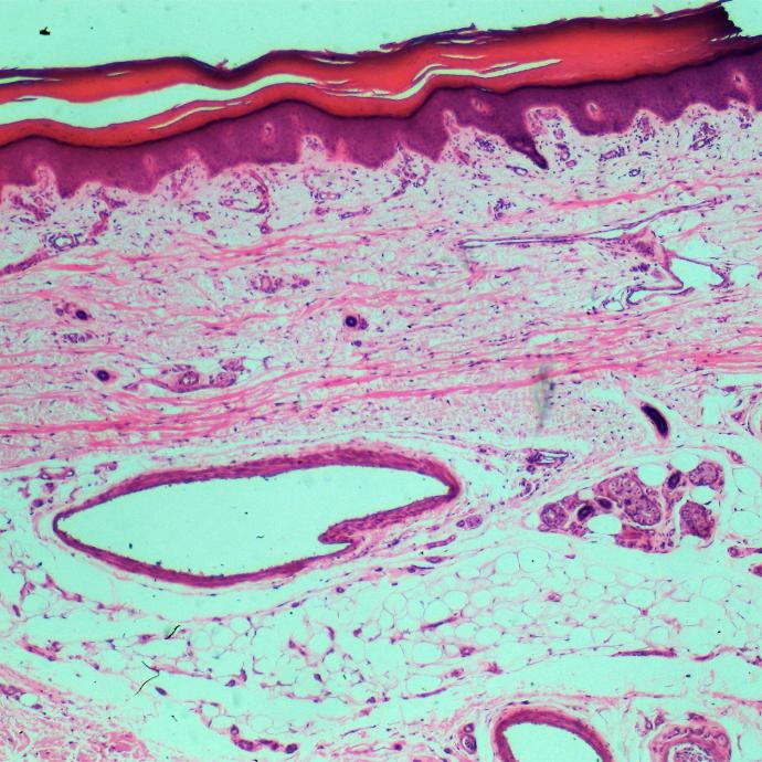 Preparación microscópica de gláncula sudorípara
