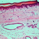 Preparación microscópica de gláncula sudorípara