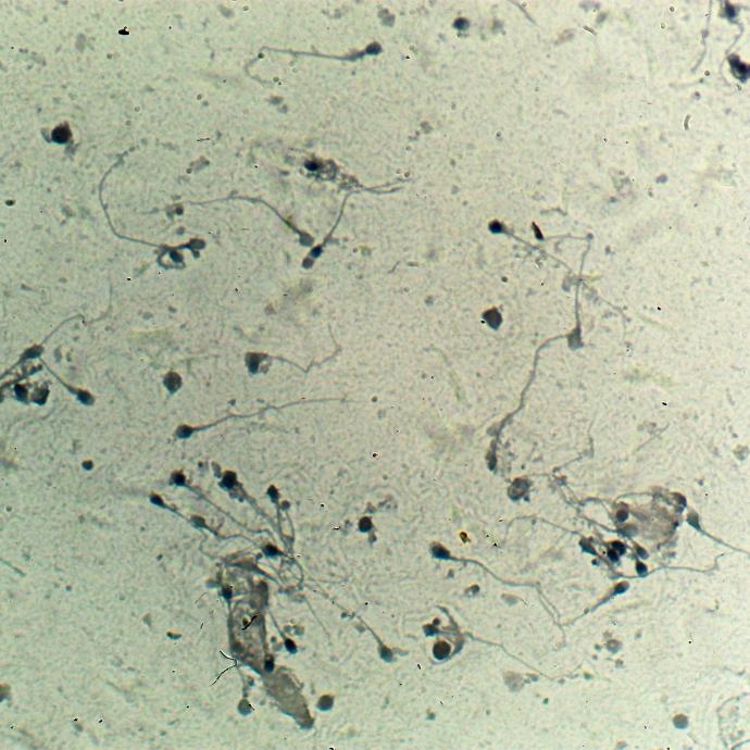 Preparación microscópica de espermatozoide humano