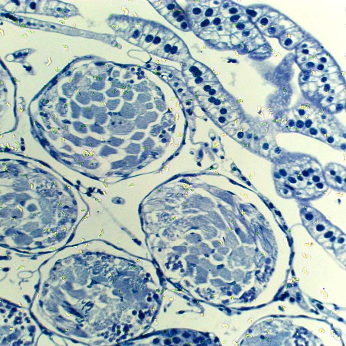 Preparación microscópica de testículos de saltamontes