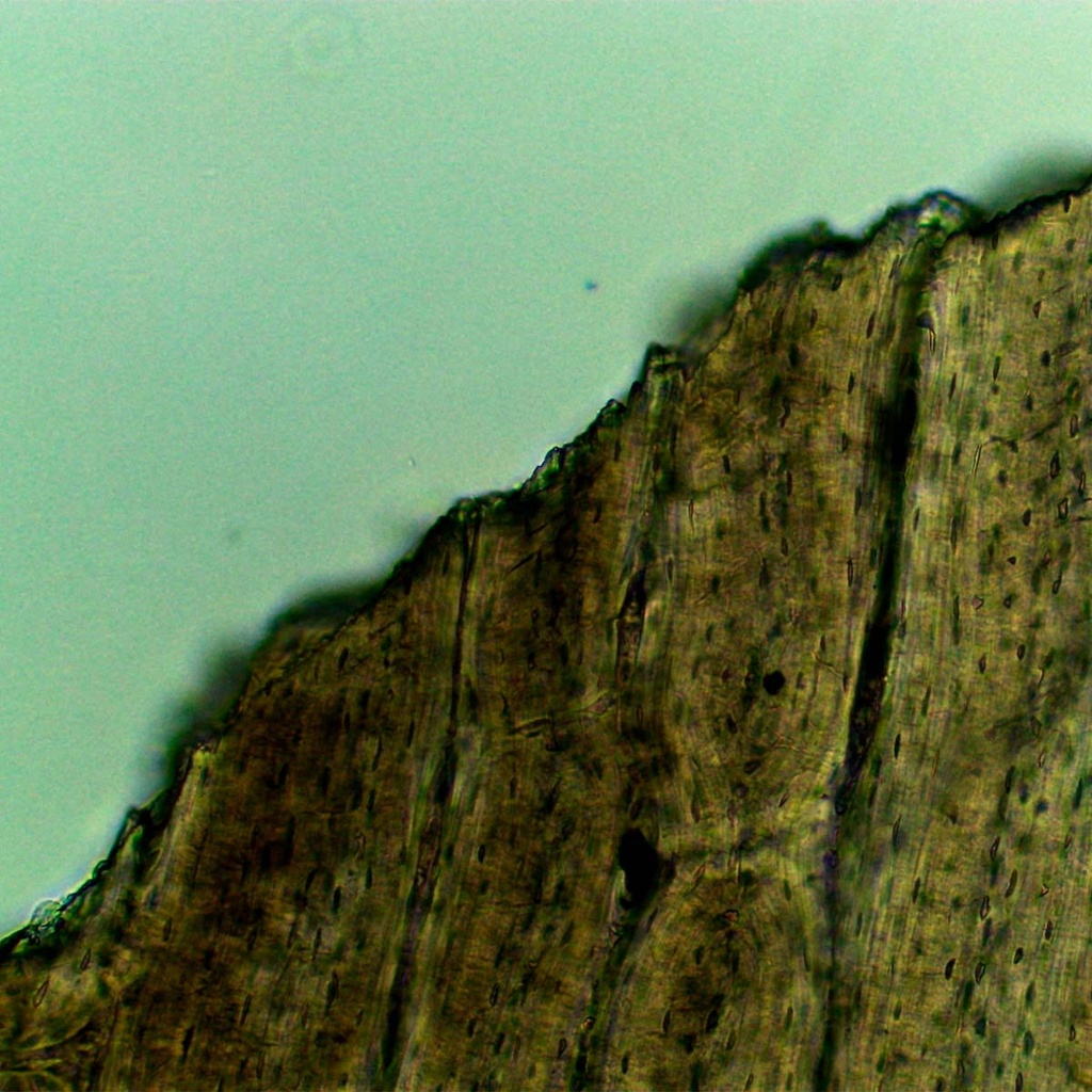 Preparación microscópica de sección de diente