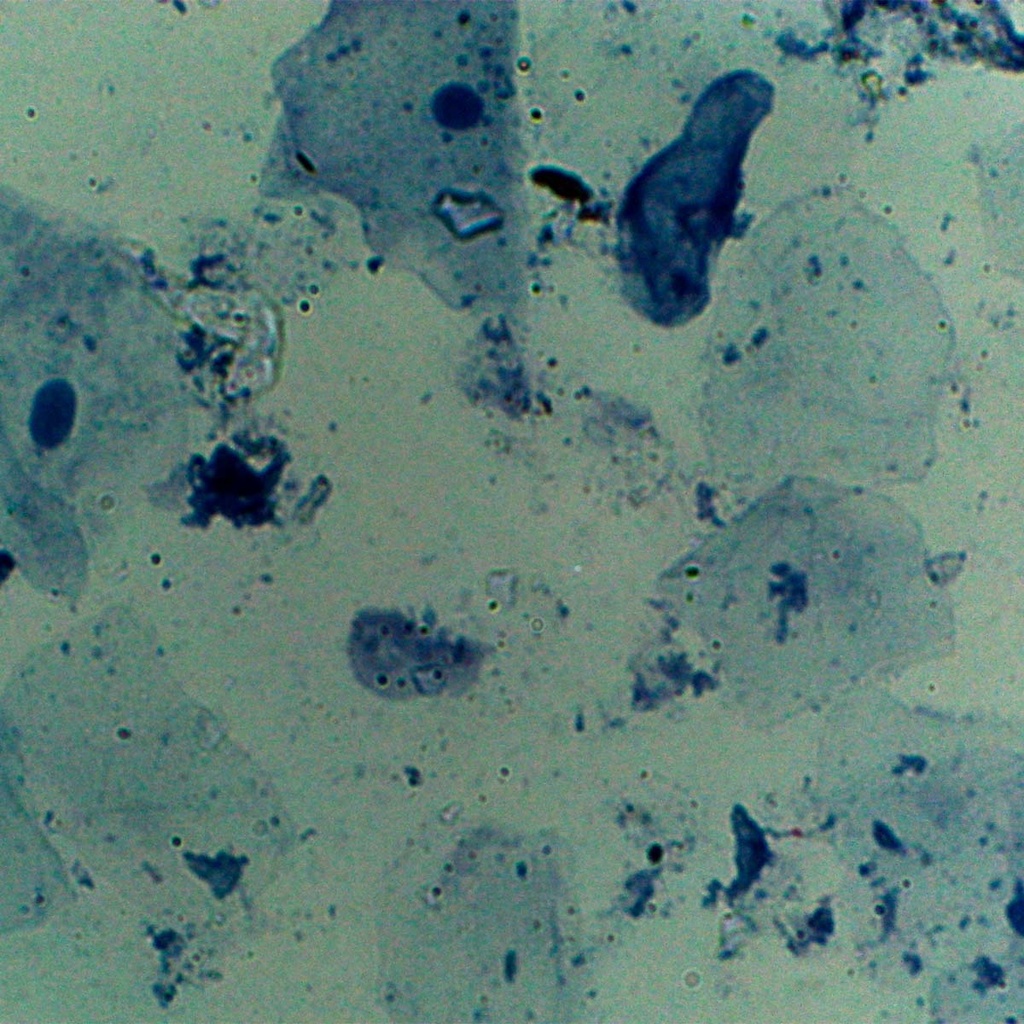 Preparación microscópica de tejido de membrana mucosa