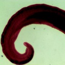Preparación microscópica de schistosoma tipo de gusano plano parásito hembra y macho en misma laminilla