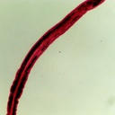 Preparación microscópica de schistosoma tipo de gusano plano parásito hémbra