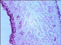 Planaria (turbelarios) gusanos planos