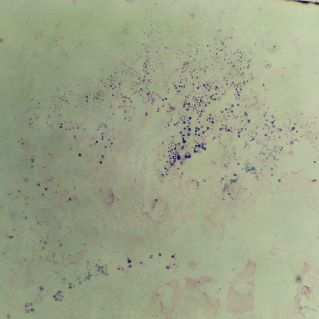 Preparación microscópica de glándula salival de mosca de fruta
